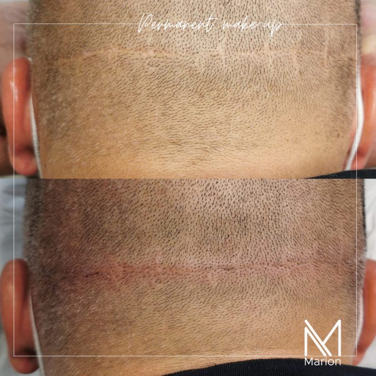 20210811_151741_0000_1