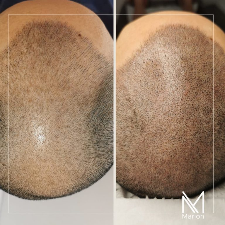 20211006_074526_0000