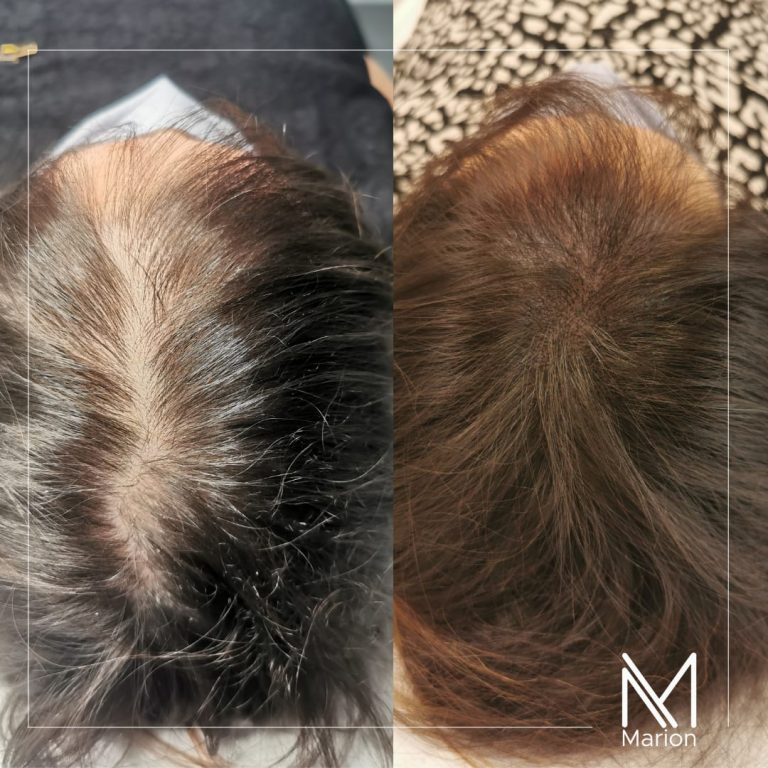 20211203_153742_0000