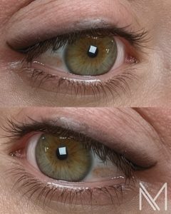 Facetune_03-12-2025-13-37-46