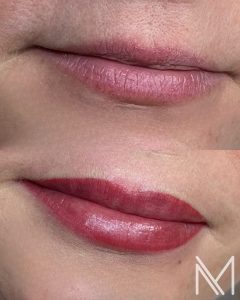 Facetune_03-12-2025-13-40-41